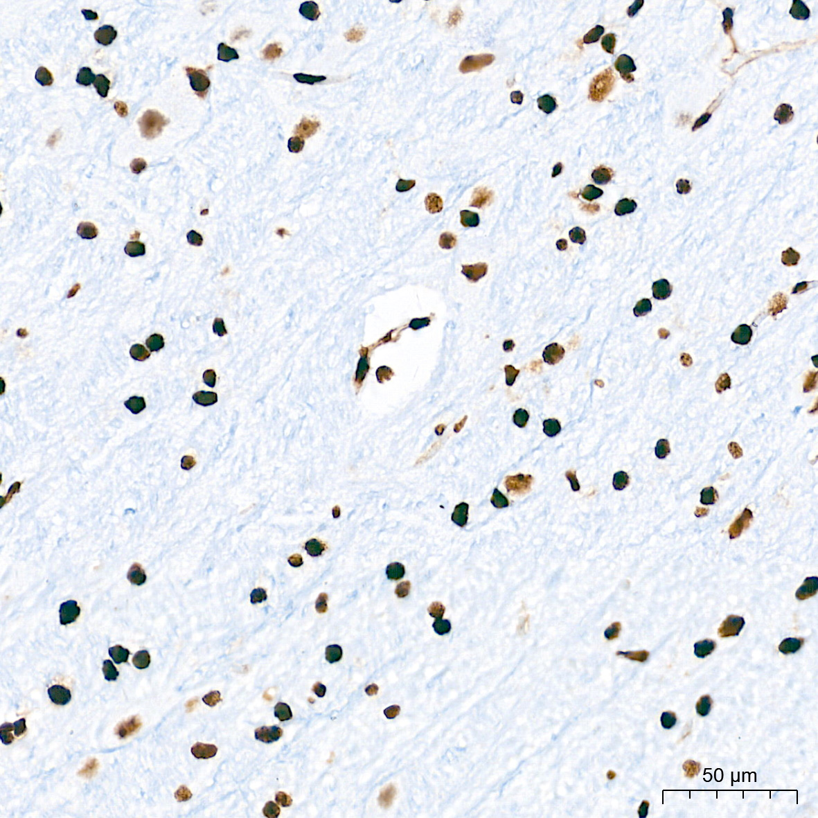 [KO Validated] HMGB1 Rabbit mAb