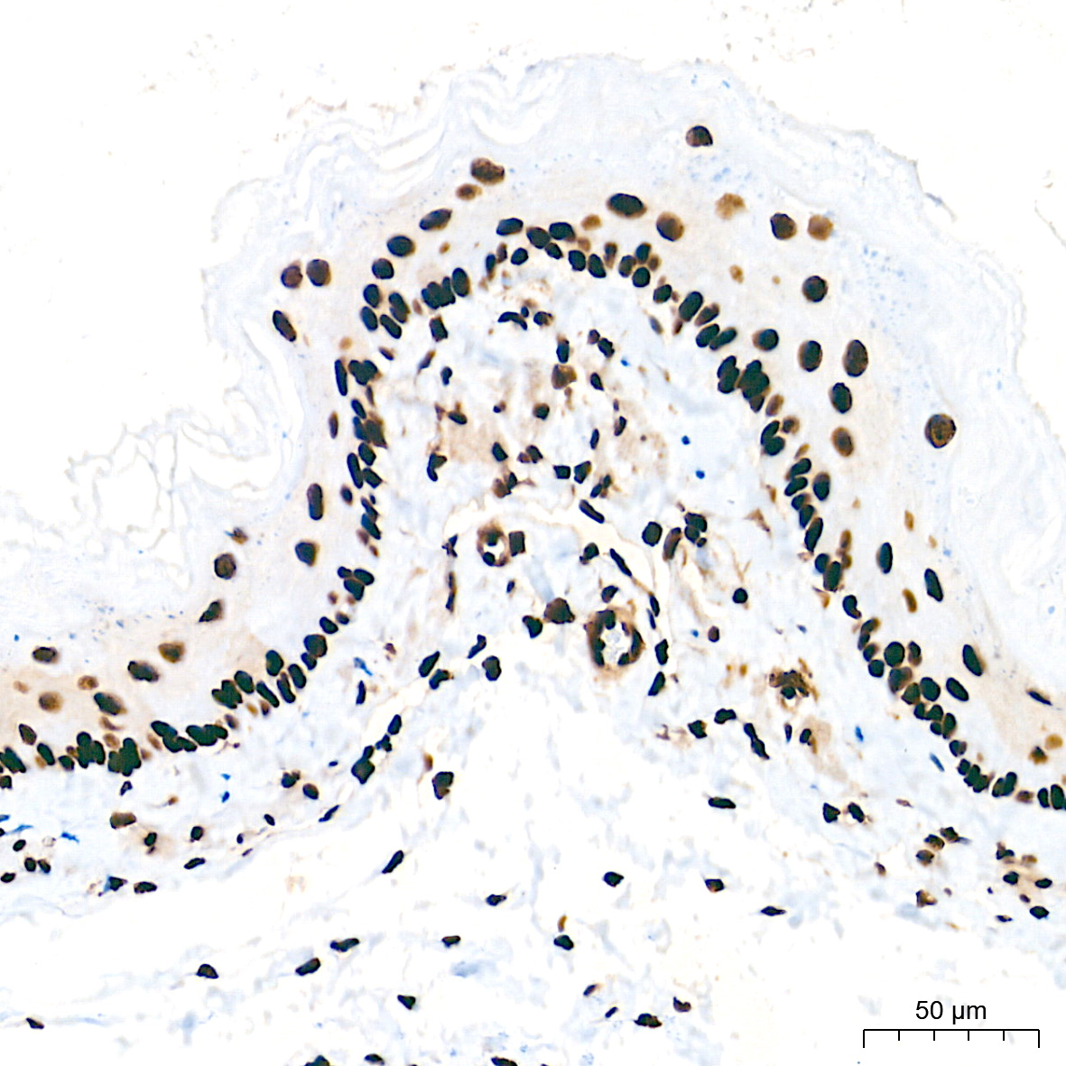[KO Validated] HMGB1 Rabbit mAb