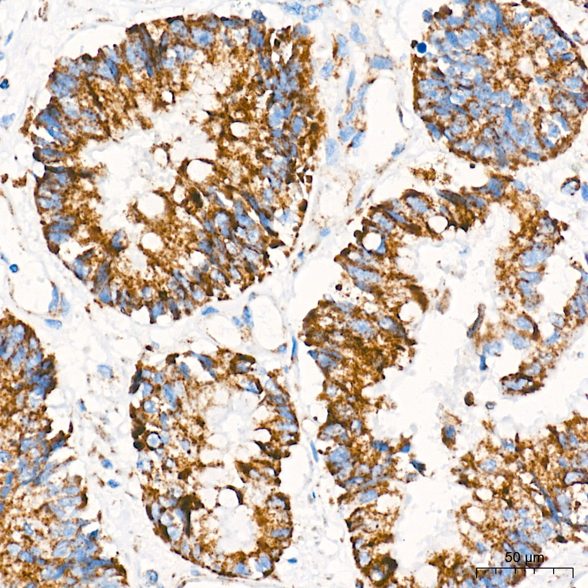 AIF Rabbit mAb
