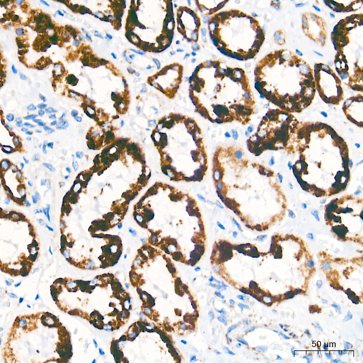 AIF Rabbit mAb