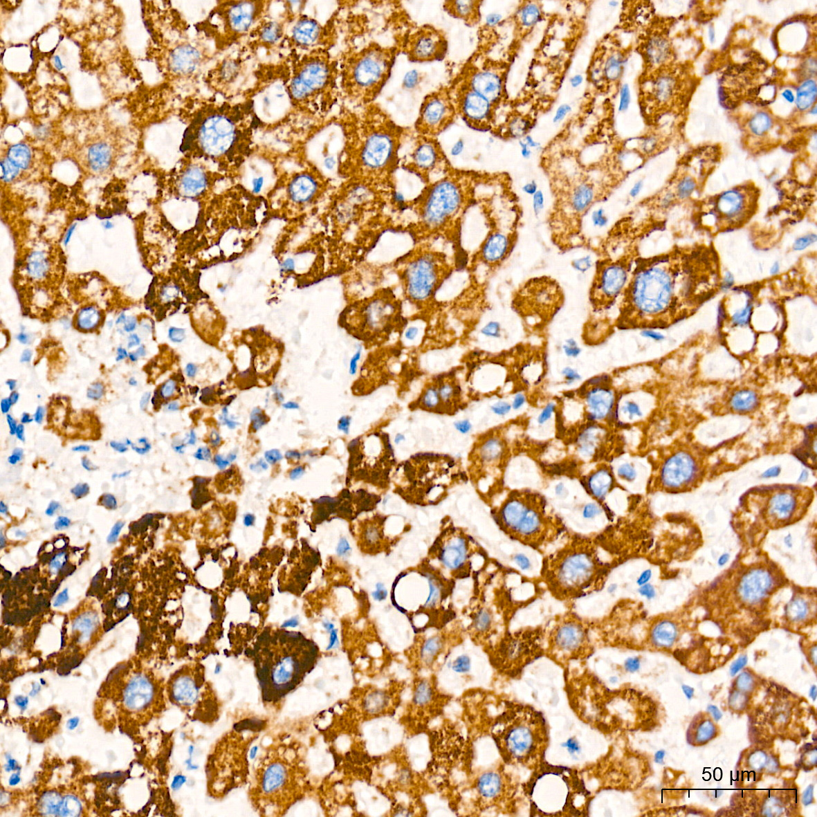 AIF Rabbit mAb
