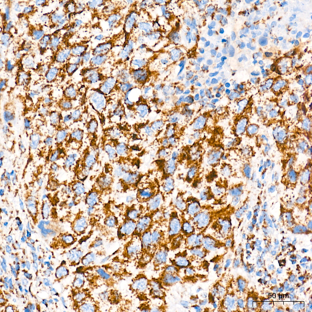 AIF Rabbit mAb