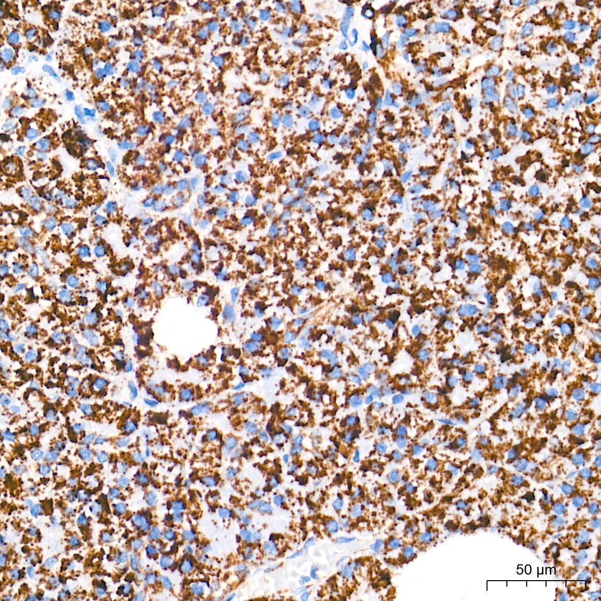 AIF Rabbit mAb
