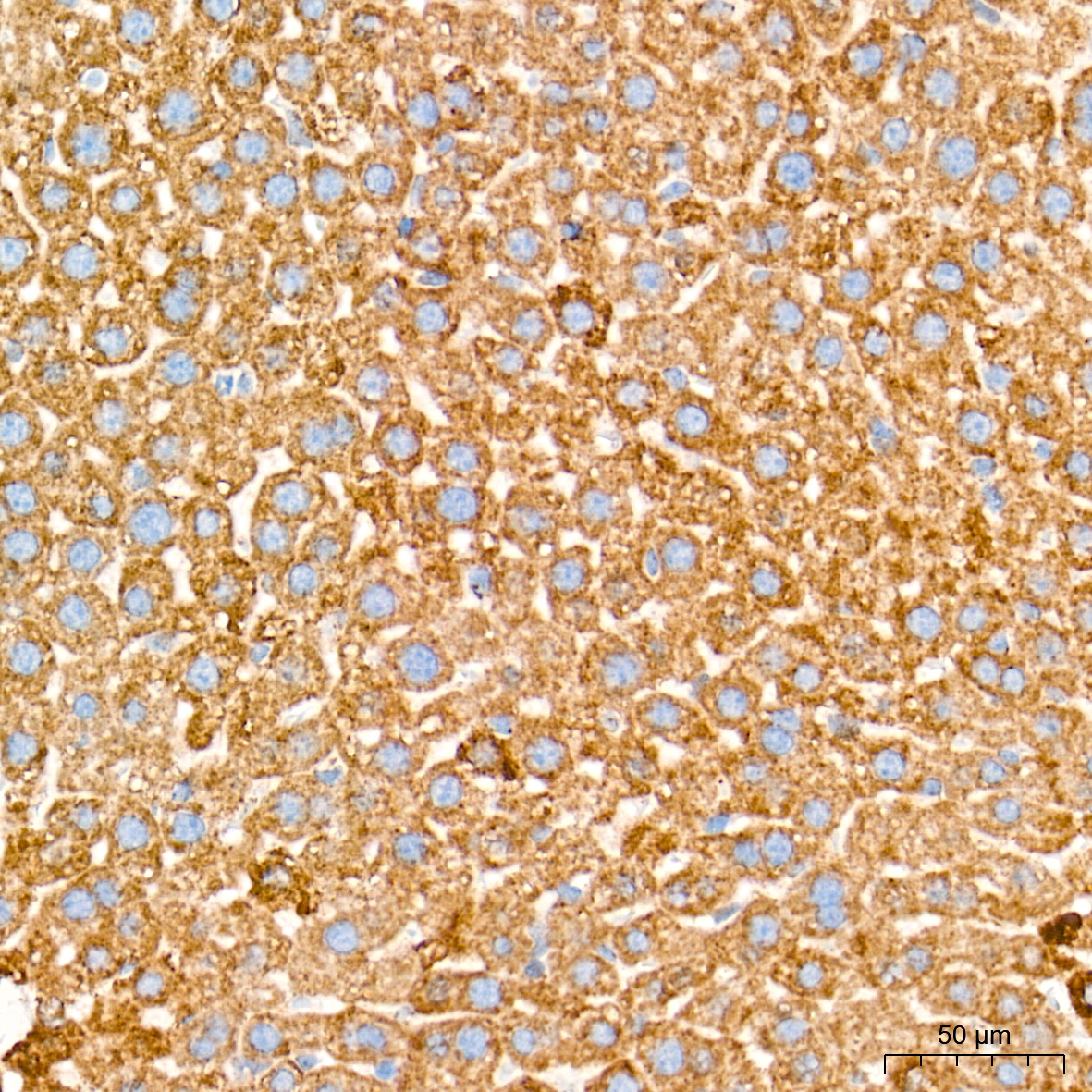 AIF Rabbit mAb