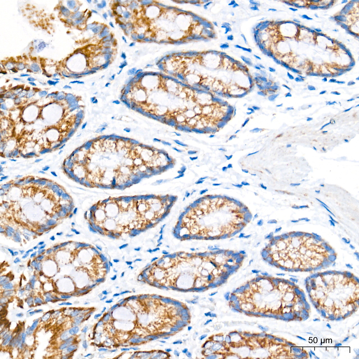 AIF Rabbit mAb