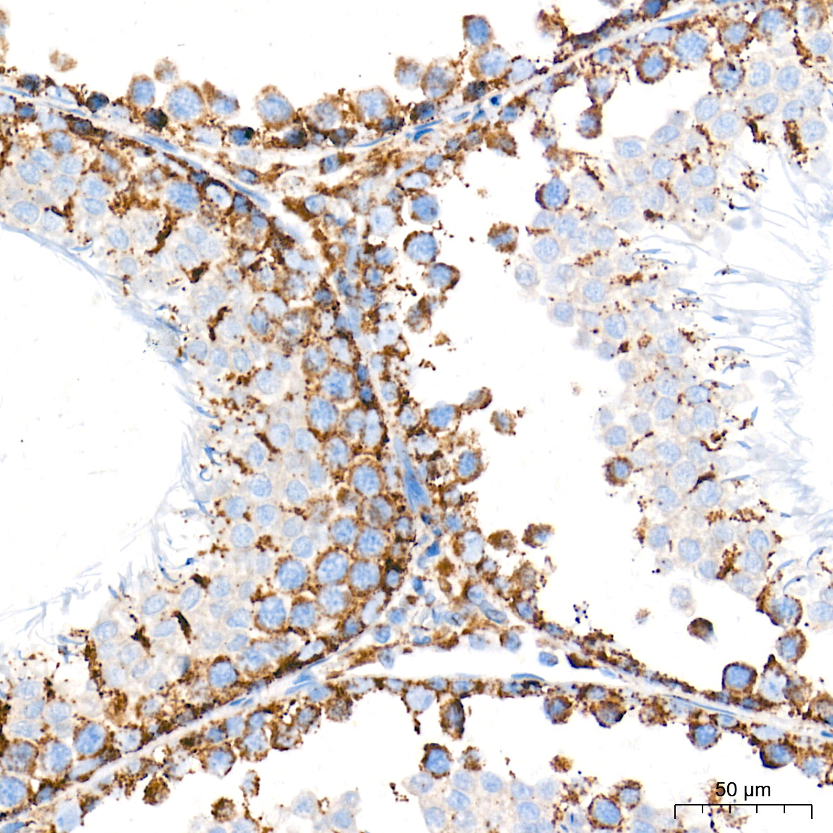 AIF Rabbit mAb