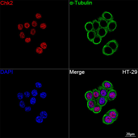 Chk2 Rabbit mAb