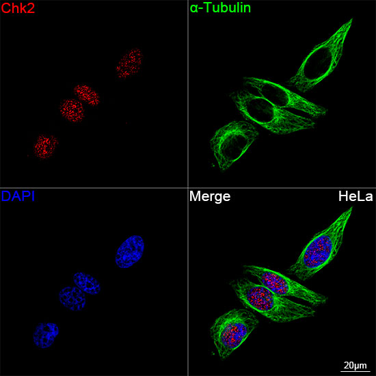 Chk2 Rabbit mAb