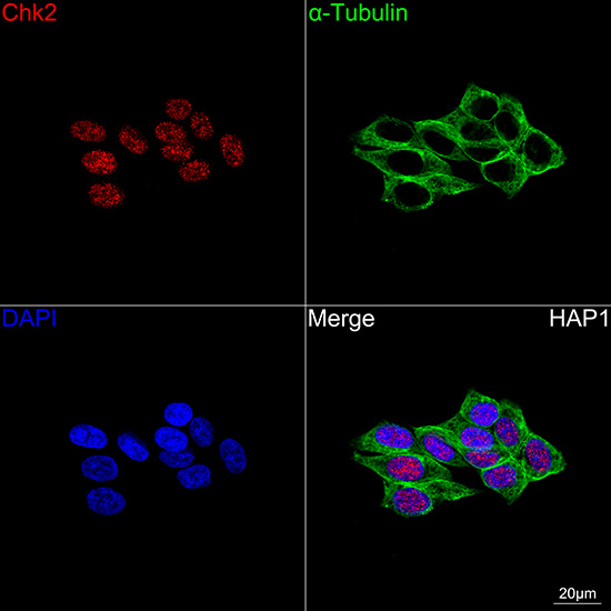 Chk2 Rabbit mAb