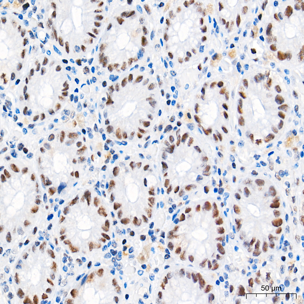 Chk2 Rabbit mAb
