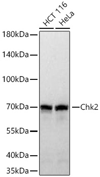 Chk2 Rabbit mAb