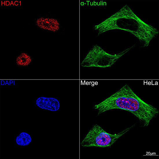 HDAC1 Rabbit mAb