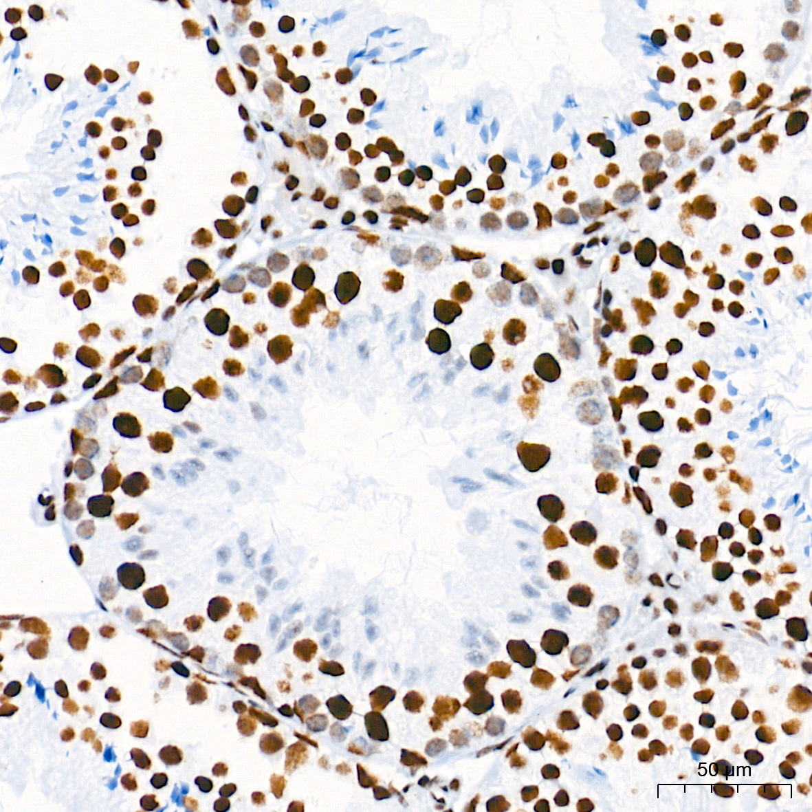[KO Validated] HDAC1 Rabbit mAb