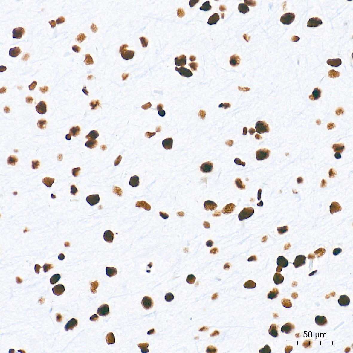 [KO Validated] HDAC1 Rabbit mAb