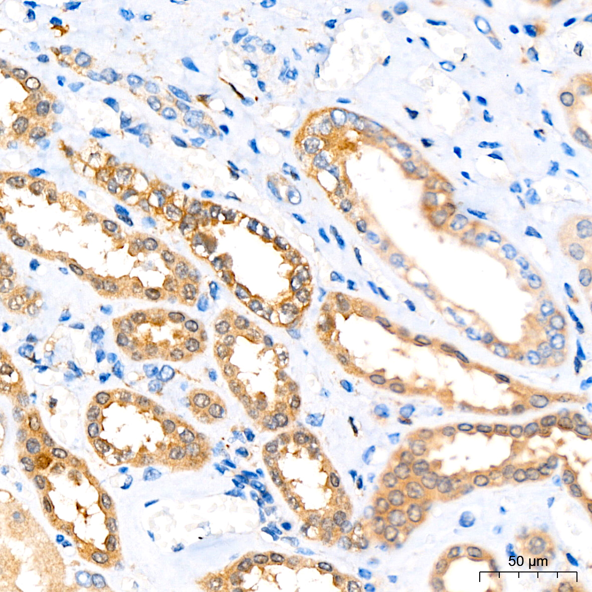 ATG3 Rabbit mAb