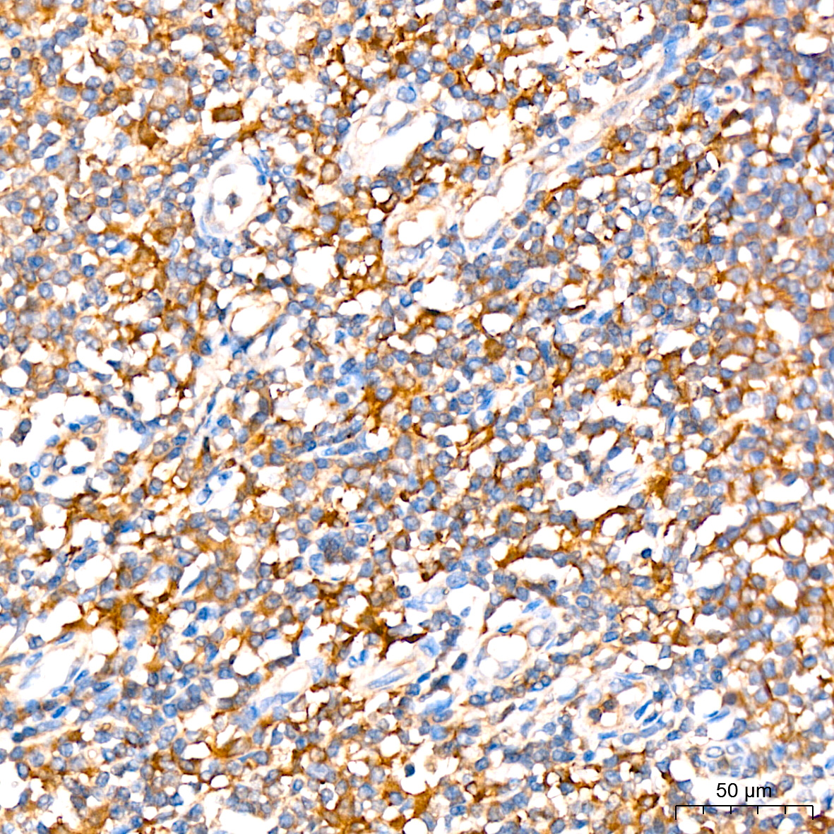 ATG3 Rabbit mAb