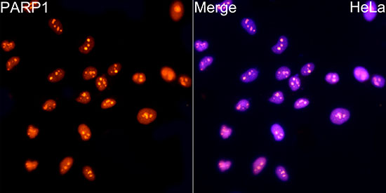 PARP1 Rabbit mAb