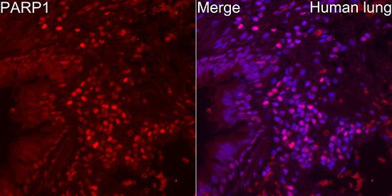 PARP1 Rabbit mAb