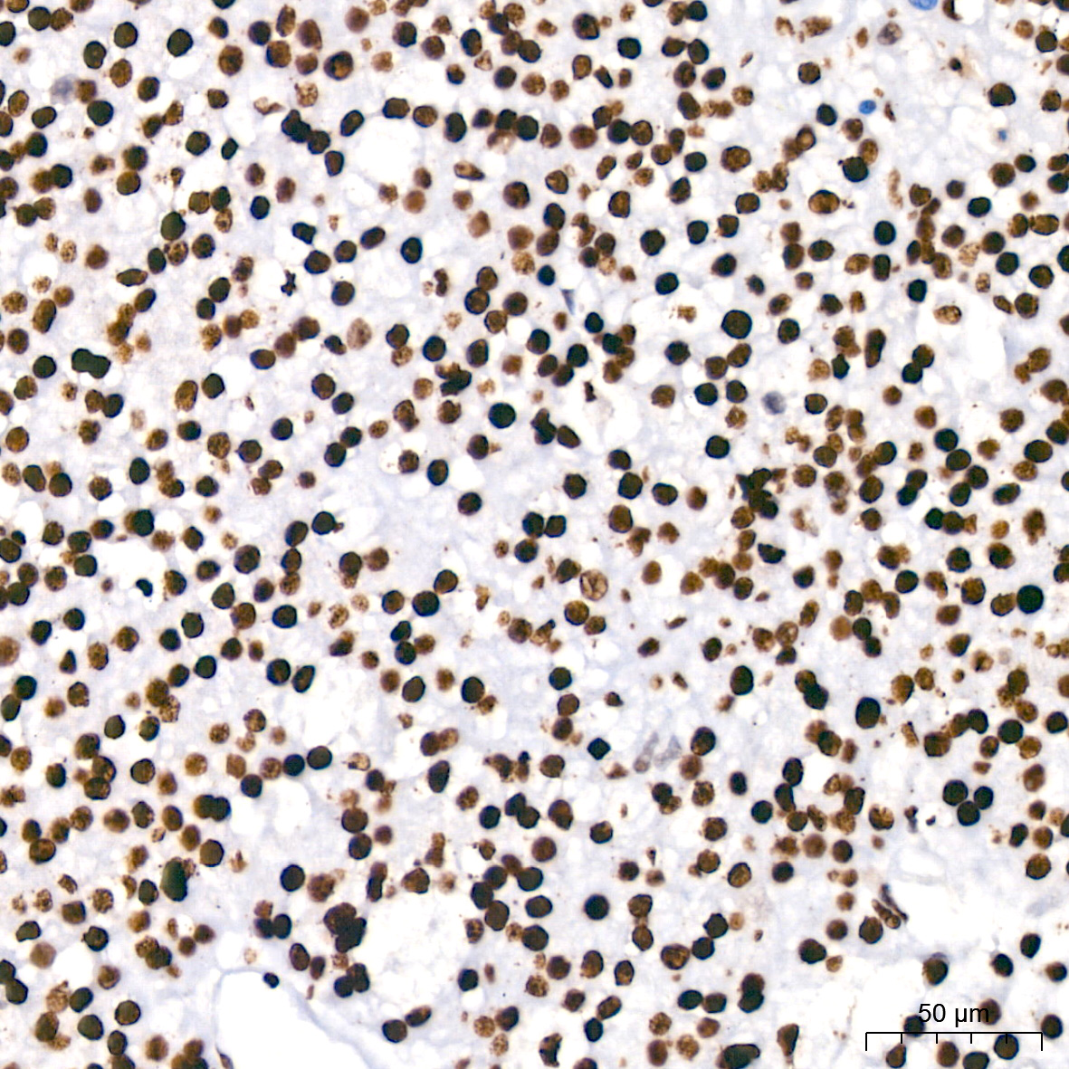 PARP1 Rabbit mAb