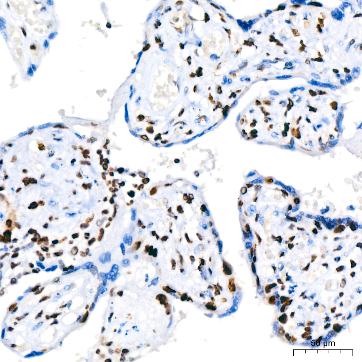 PARP1 Rabbit mAb
