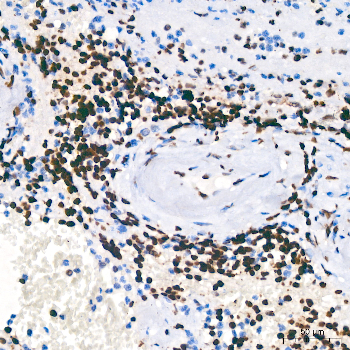 PARP1 Rabbit mAb