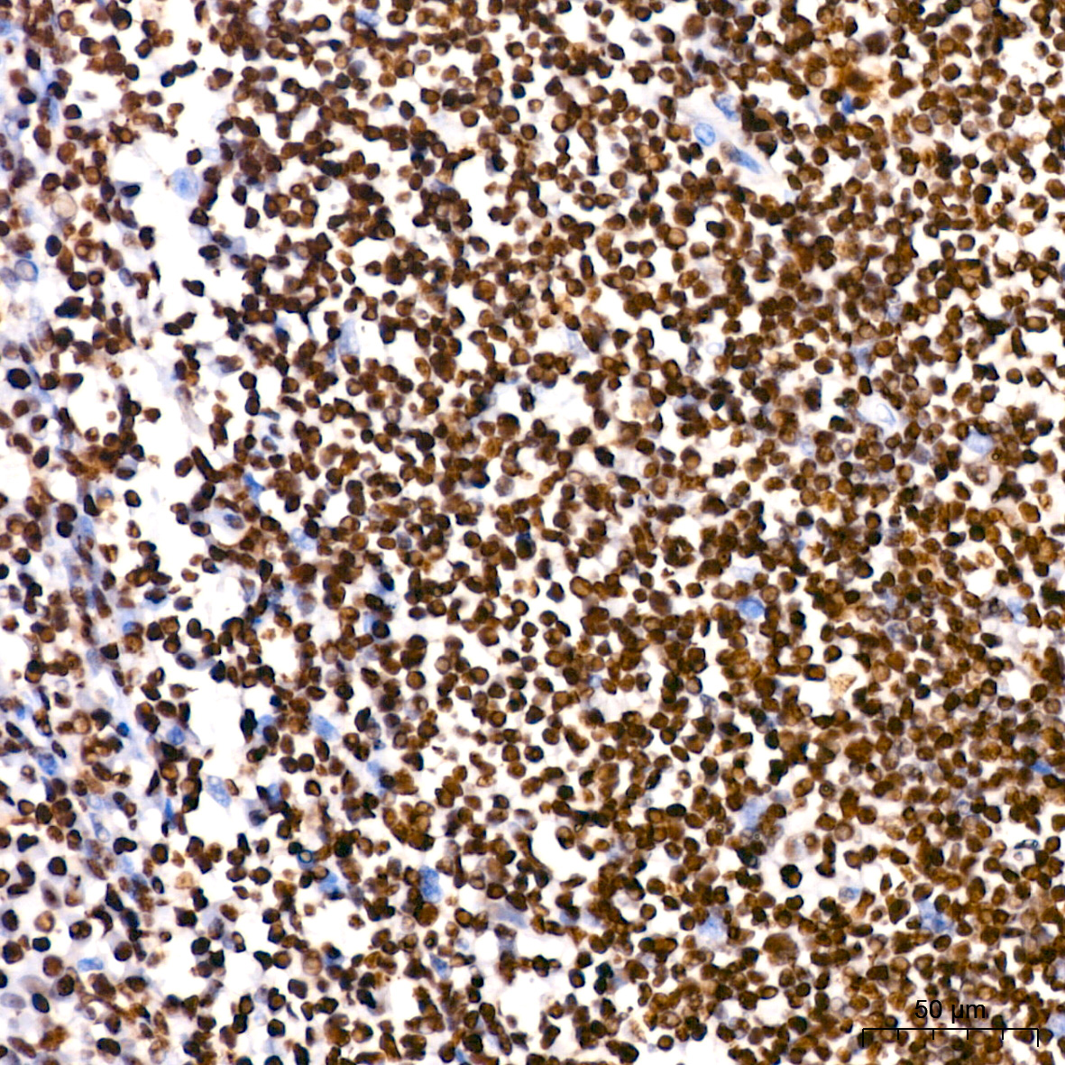 PARP1 Rabbit mAb