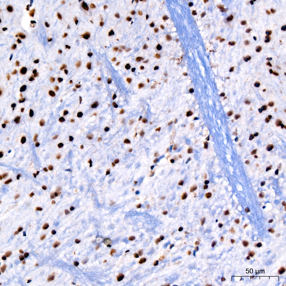 PARP1 Rabbit mAb