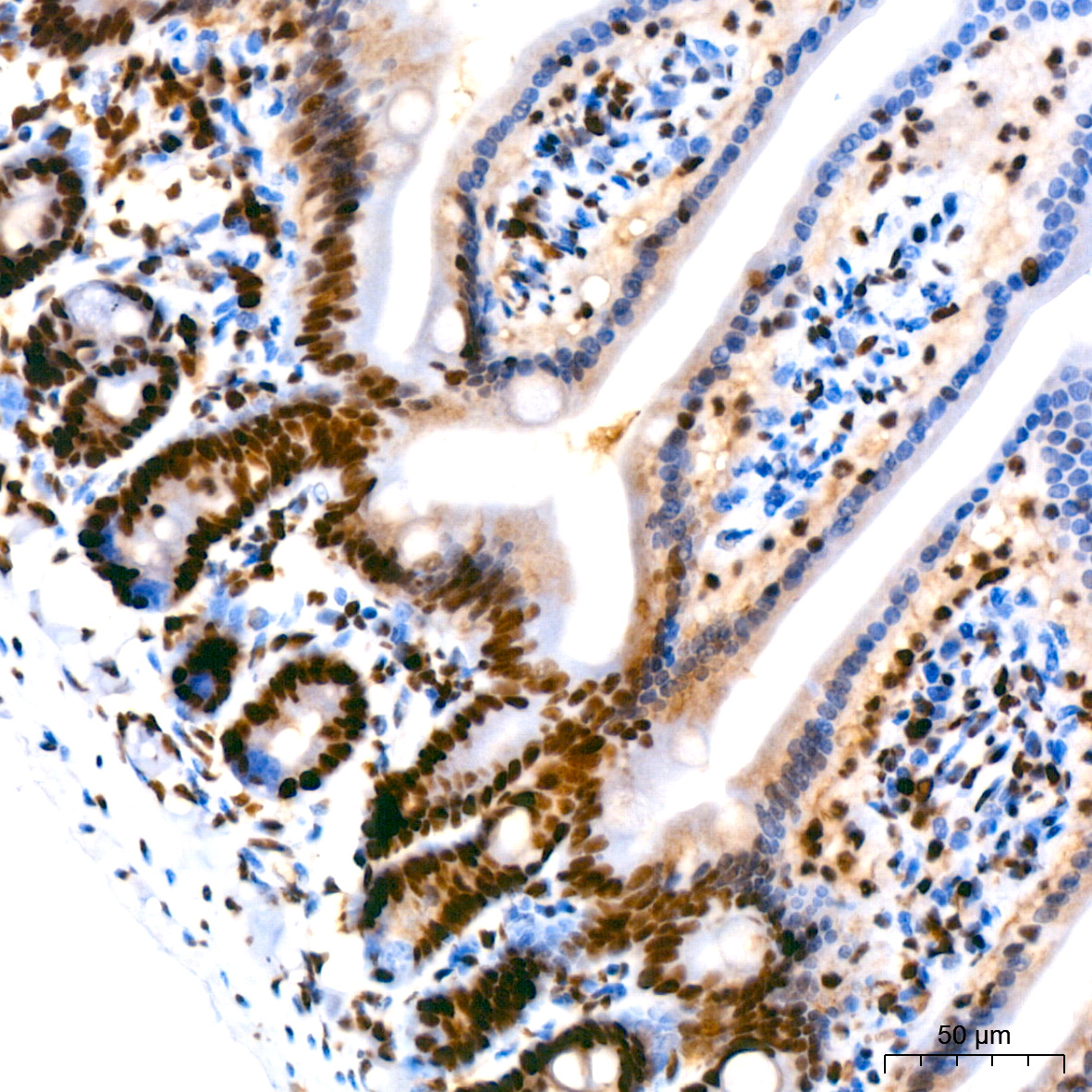 PARP1 Rabbit mAb