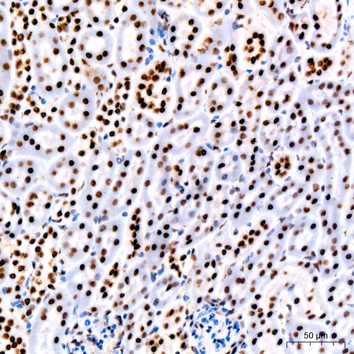 PARP1 Rabbit mAb