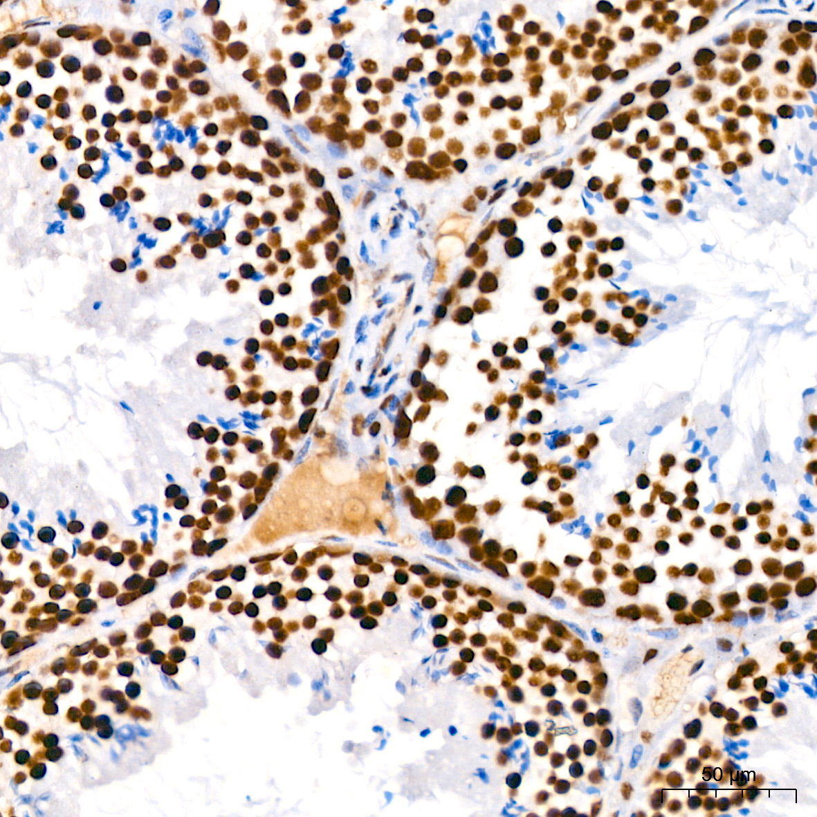 PARP1 Rabbit mAb