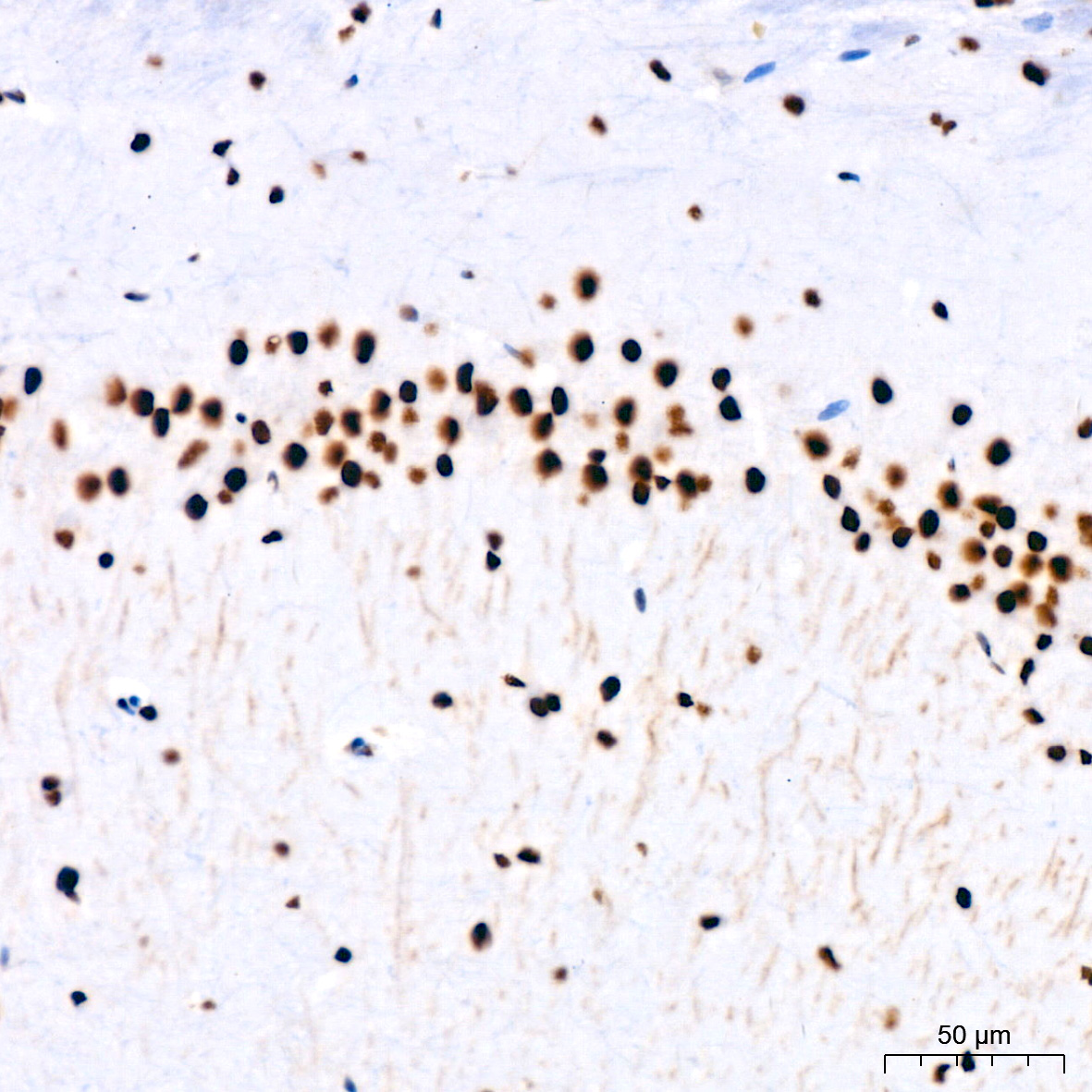 PARP1 Rabbit mAb