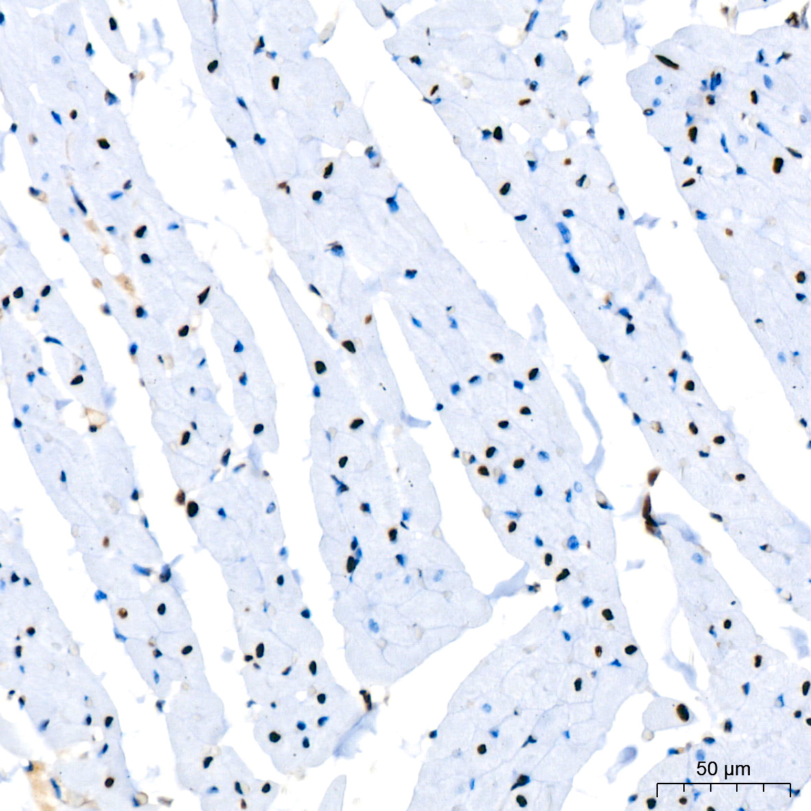 PARP1 Rabbit mAb