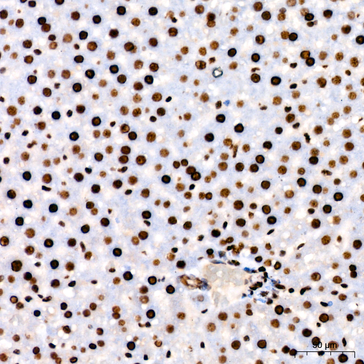 PARP1 Rabbit mAb