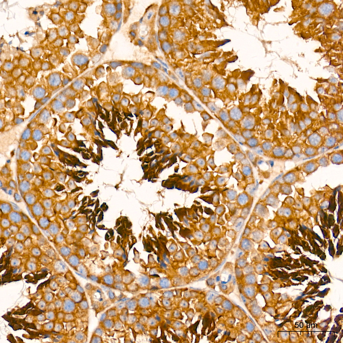 [KD Validated] ATG7 Rabbit mAb