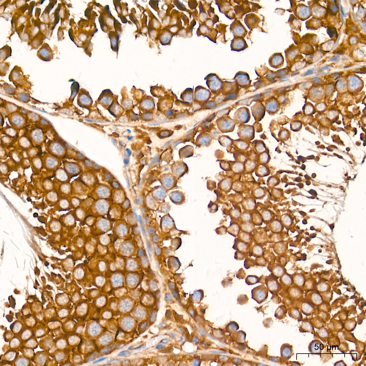 [KD Validated] ATG7 Rabbit mAb