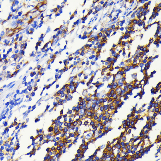 NF-κB2 Rabbit mAb