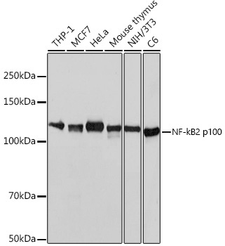 NF-κB2 Rabbit mAb