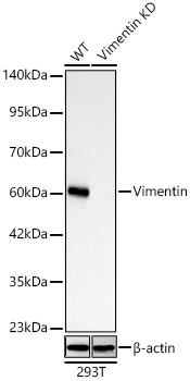 [KD Validated] Vimentin Rabbit mAb