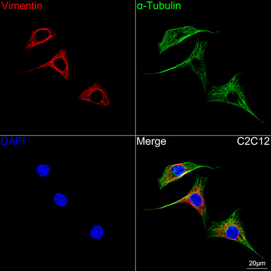 [KD Validated] Vimentin Rabbit mAb
