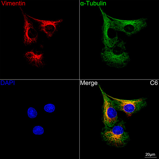 [KD Validated] Vimentin Rabbit mAb