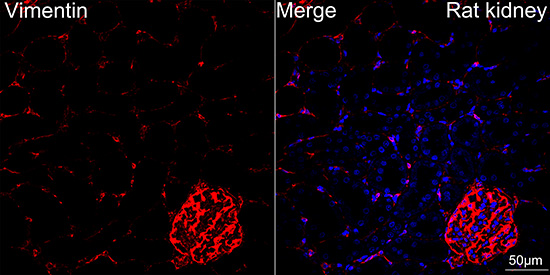 [KD Validated] Vimentin Rabbit mAb