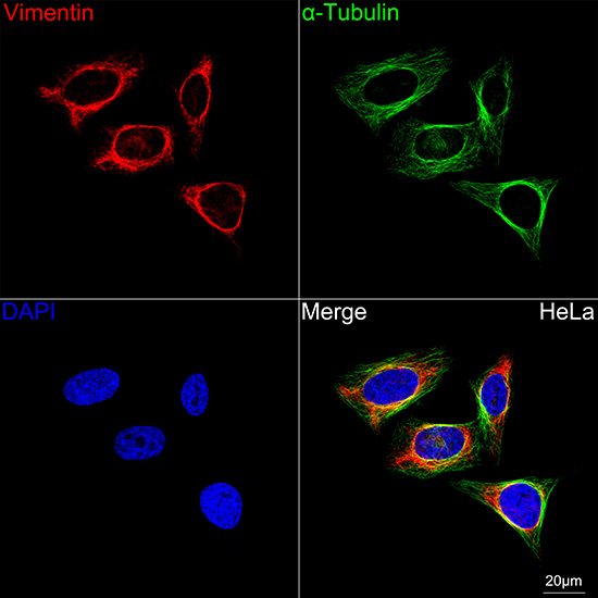 [KD Validated] Vimentin Rabbit mAb