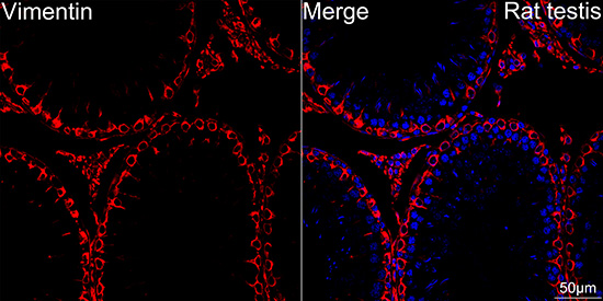 [KD Validated] Vimentin Rabbit mAb