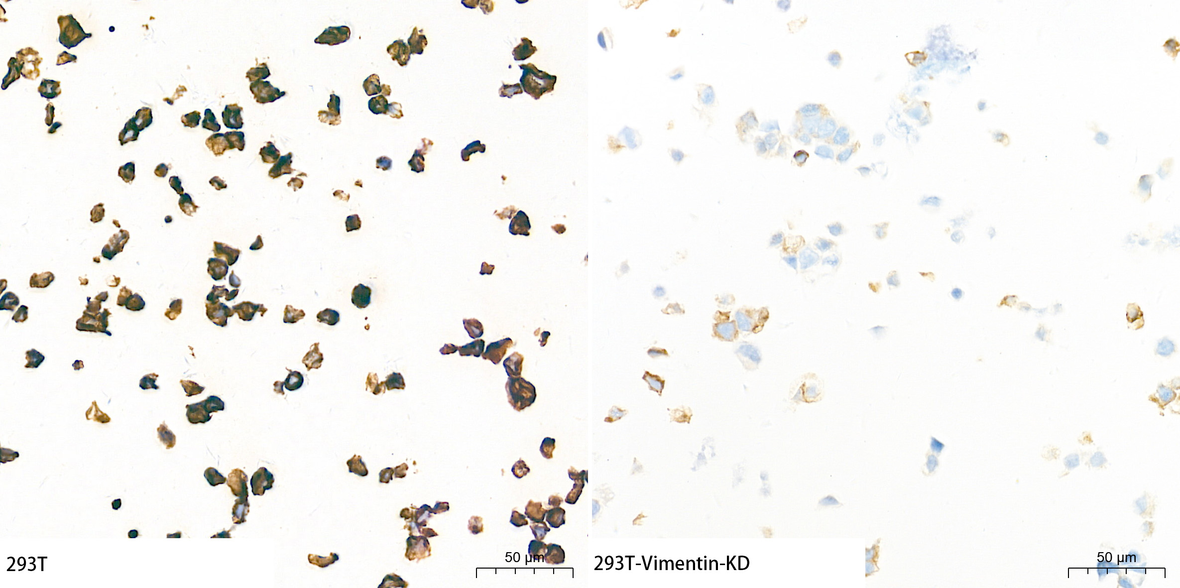 [KD Validated] Vimentin Rabbit mAb