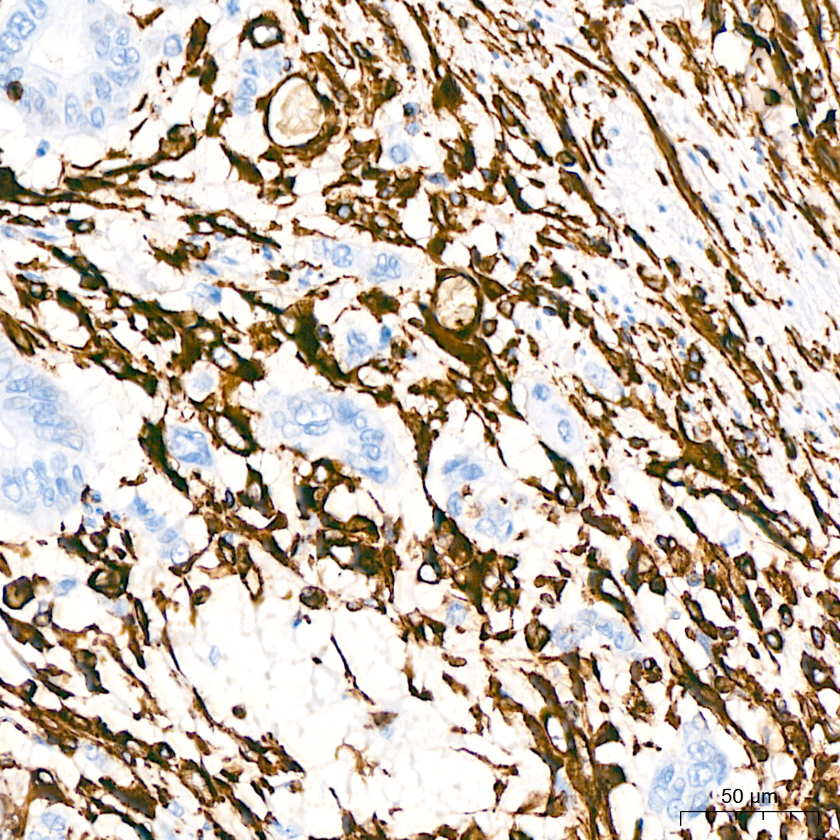 [KD Validated] Vimentin Rabbit mAb