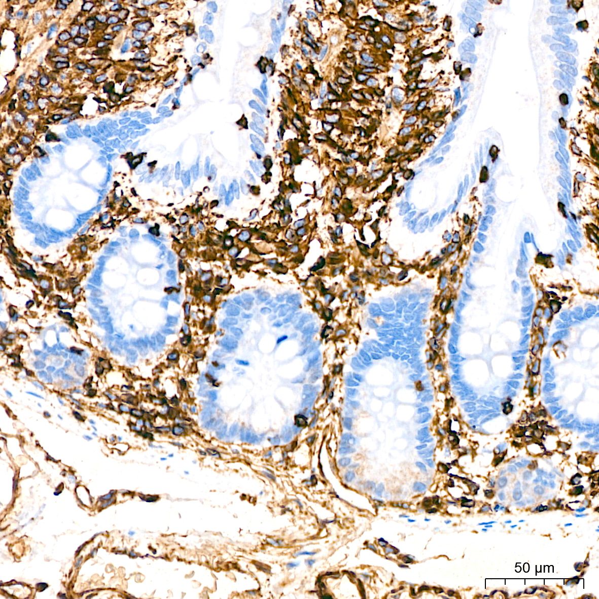 [KD Validated] Vimentin Rabbit mAb