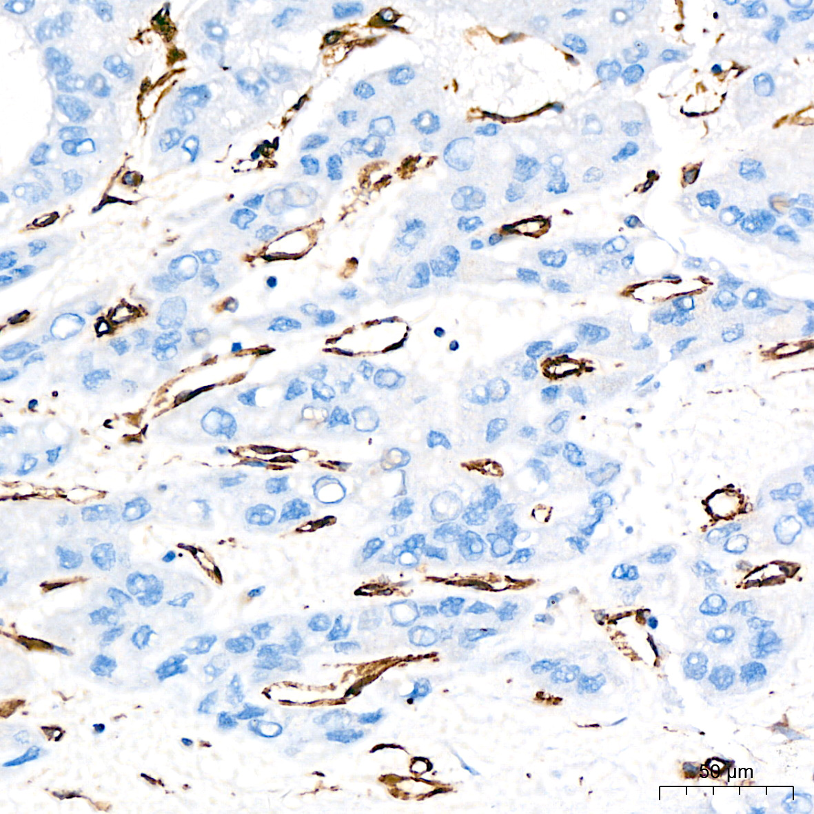 [KD Validated] Vimentin Rabbit mAb