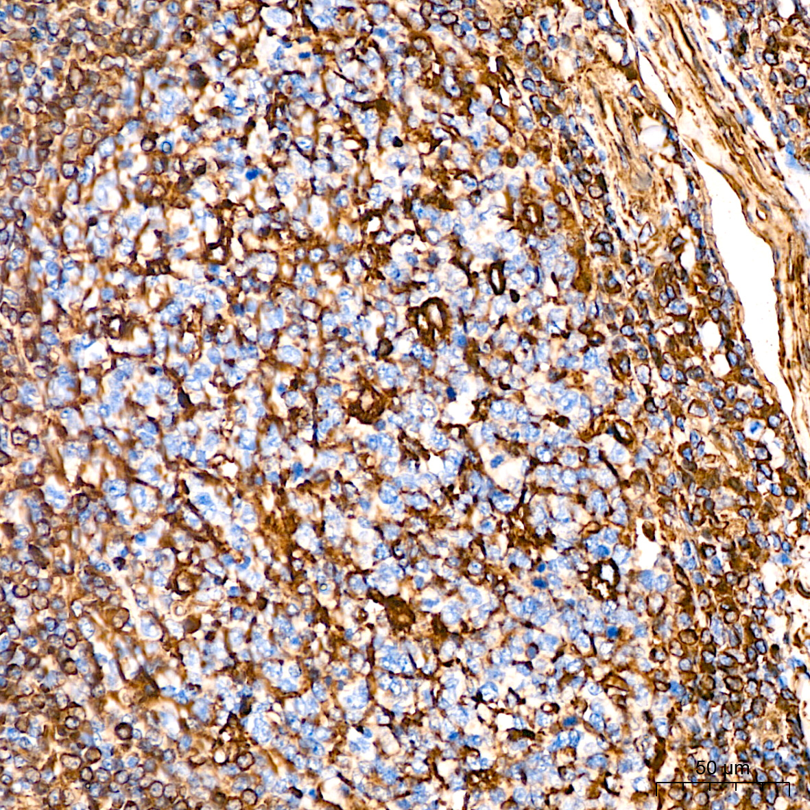 [KD Validated] Vimentin Rabbit mAb