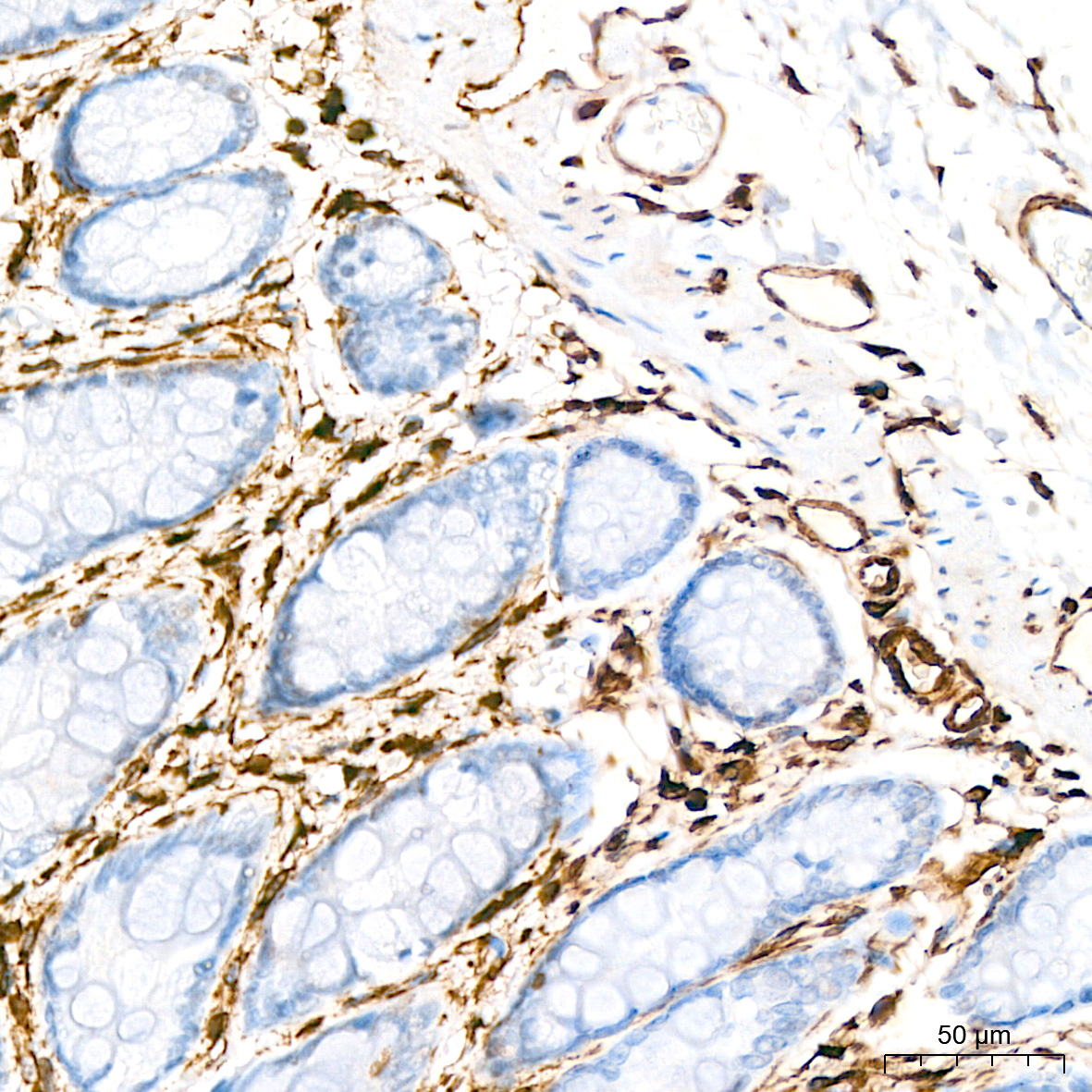 [KD Validated] Vimentin Rabbit mAb