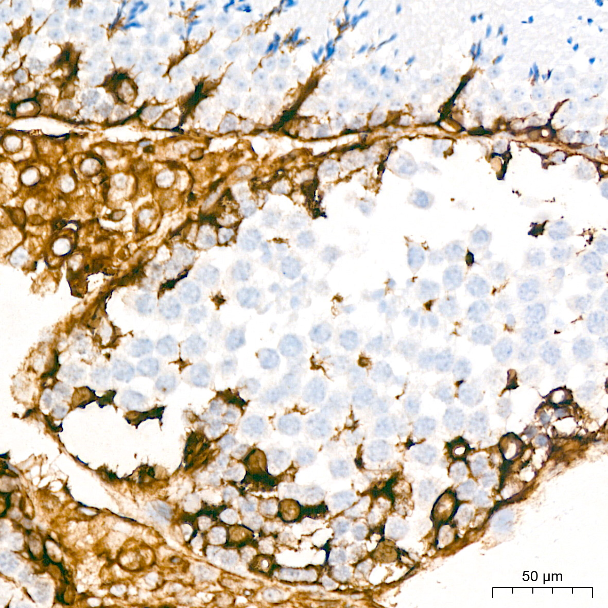 [KD Validated] Vimentin Rabbit mAb
